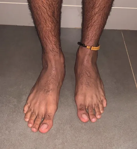 Dominican Feet