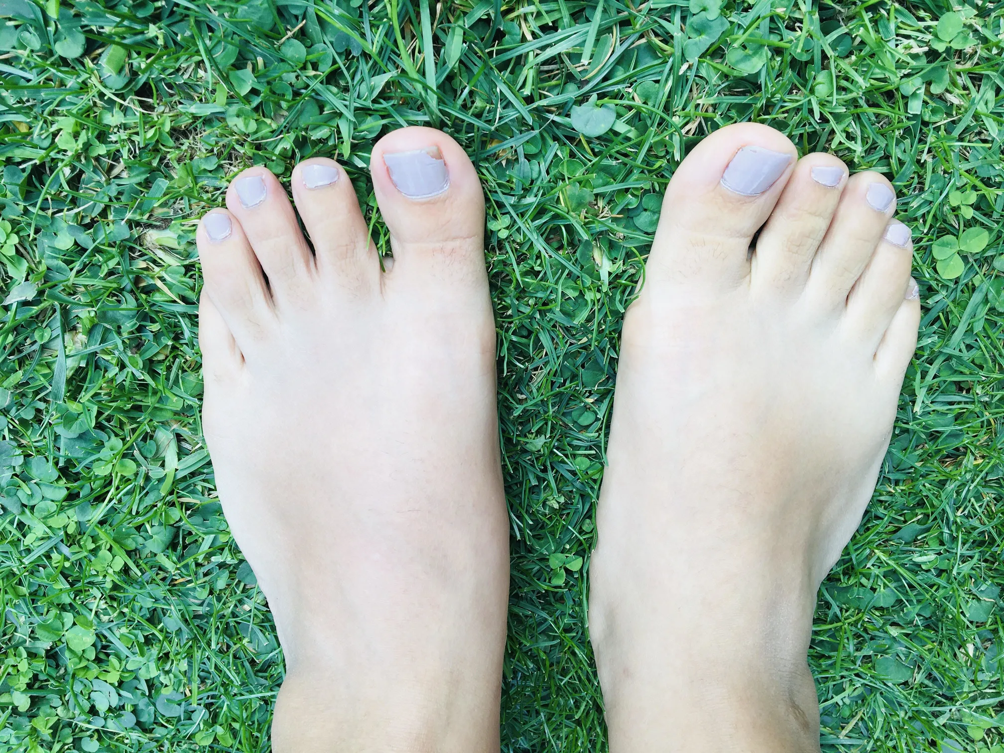 Mel Feet