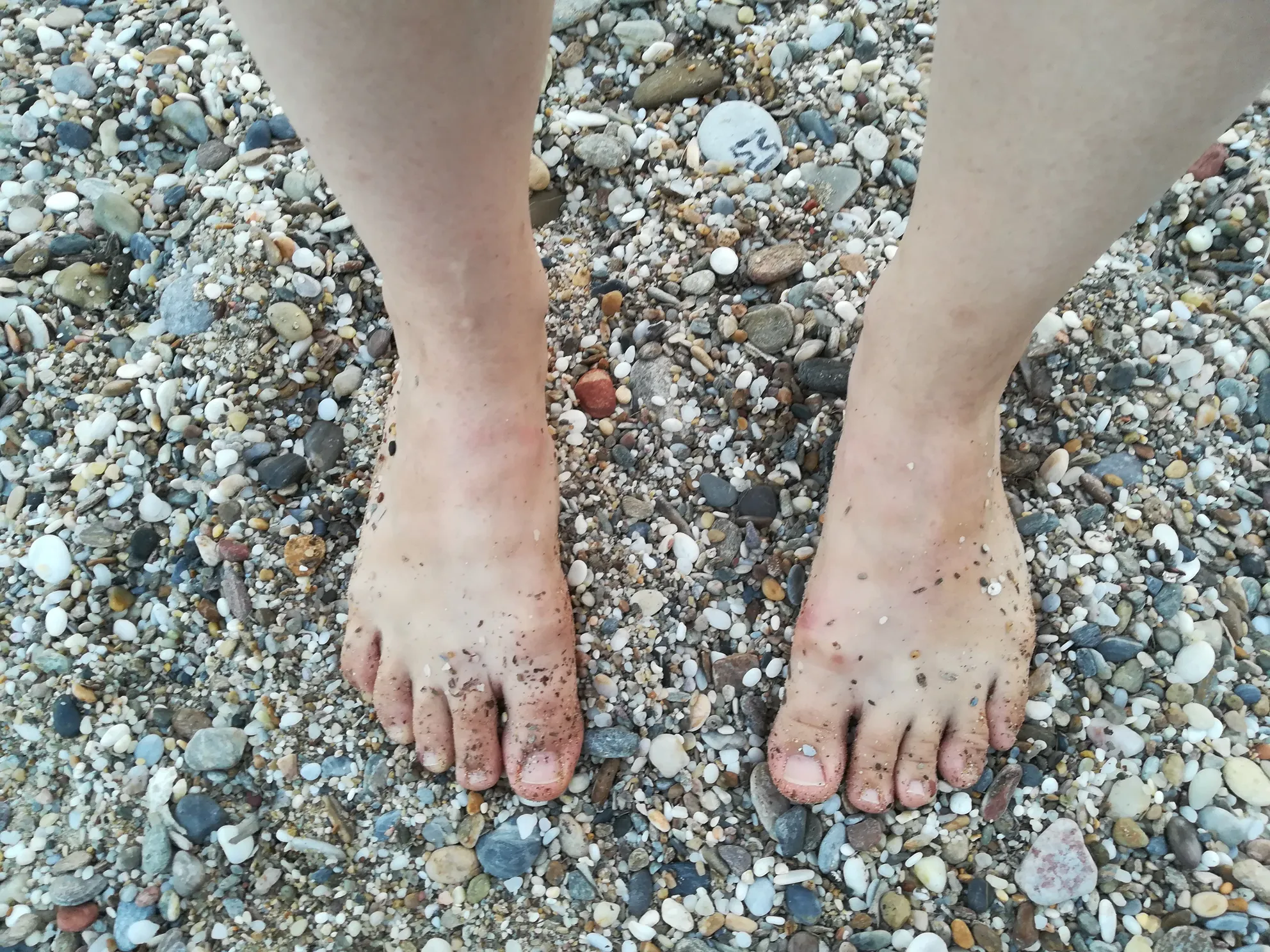 HippyToes