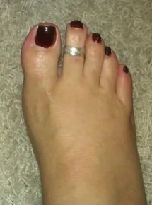 Fattyfeet