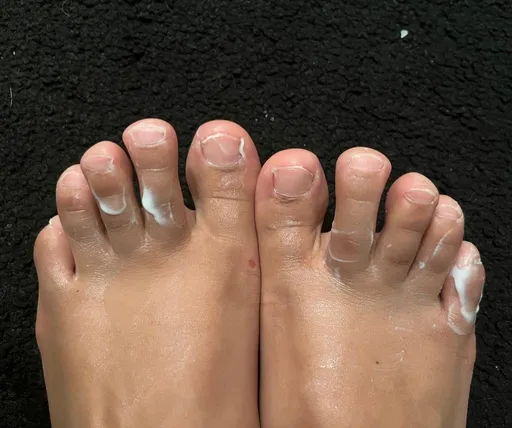 flat feet