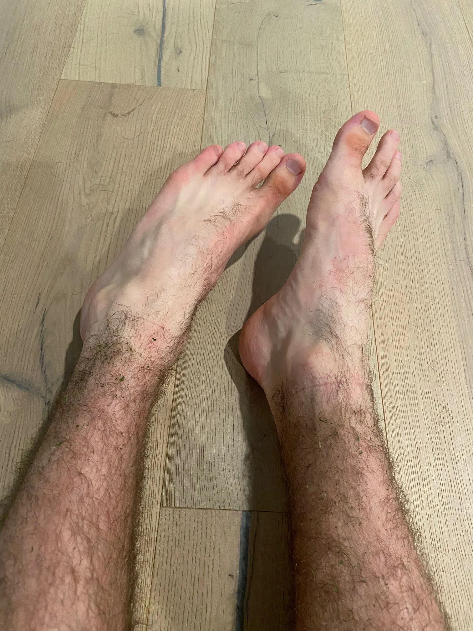 Mr. Hairy Feet &amp; Legs