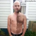 Hairy Navel