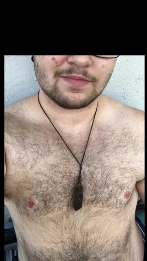 Trans boy